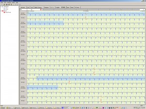 complete-5-lead-ecg-recording