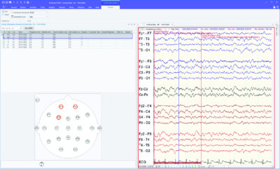 Profusion EEG Software – Compumedics