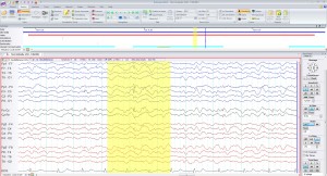 eeg5-reviewsummary-center