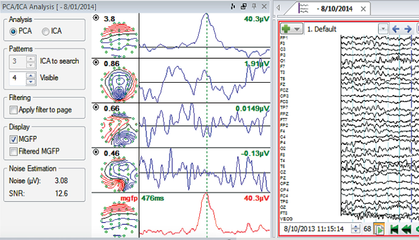 Profusion EEG Software Compumedics